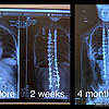 4-month x-rays look very good.<br><div class='photoDatesPopup'><br>from Elise's Photos taken 2/11/2022 and posted 8/19/2022</div>